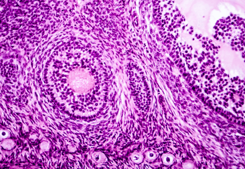 Histopathology image